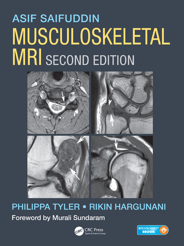 Musculoskeletal MRI Second Edition ASIF SAIFUDDIN BSc Hons MBChB MRCP - photo 1