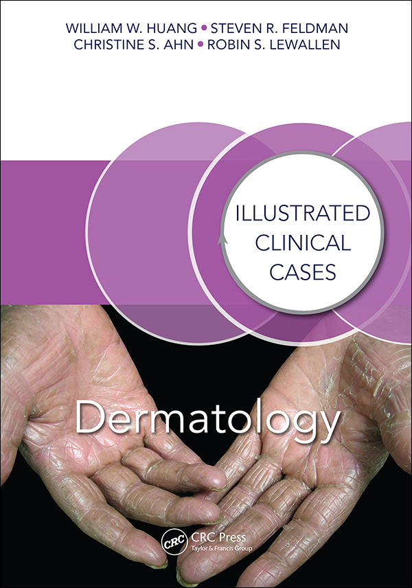 Dermatology Dermatology EDITED BY WILLIAM W HUANG MD MPH Associate - photo 1