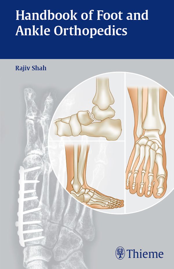 Handbook of Foot and Ankle Orthopedics Rajiv Shah MS Ortho Managing - photo 1