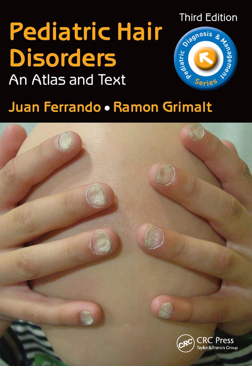 Third Edition Pediatric Hair Disorders An Atlas and Text Pediatric Diagnosis - photo 1