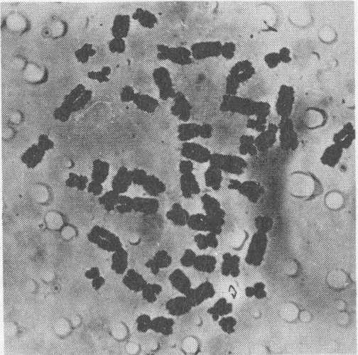 Cell after treatment with salt solution The separate chromosomes in a - photo 6