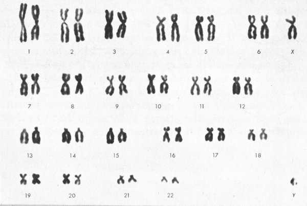 The separate chromosomes in a dividing cell are photographed and then can be - photo 7