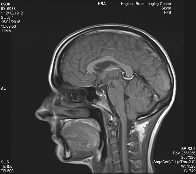 Fig 1 An MRI scan of the authors brain Courtesy of the University of Kansas - photo 2
