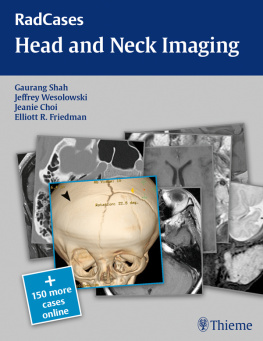 Gaurang Vrindavan Shah - RadCases head and neck imaging