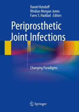 Daniel Kendoff - Periprosthetic Joint Infections: Changing Paradigms