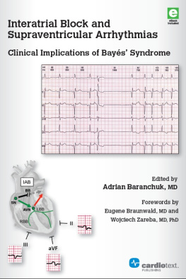 Adrian Baranchuk (ed.) - Interatrial Block and Supraventricular Arrhythmias: Clinical Implications of Bayes’ Syndrome
