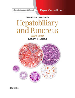 Laura W. Lamps - Hepatobiliary and Pancreas