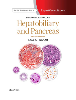 Laura W. Lamps Hepatobiliary and Pancreas