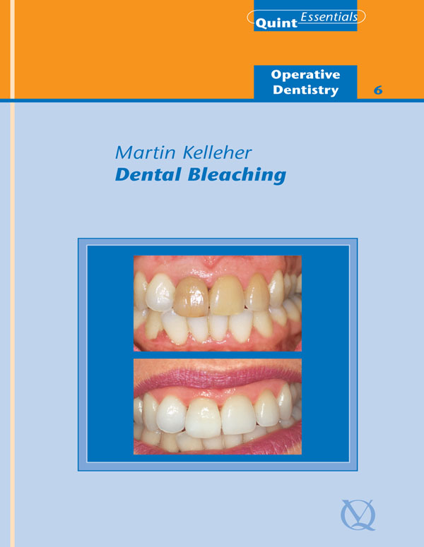 Quintessentials of Dental Practice 38 Operative Dentistry 6 Dental Bleaching - photo 1