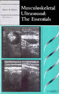 title Musculoskeletal Ultrasound The Essentials author Gibbon - photo 1