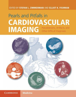 Fishman Elliot K. Pearls and pitfalls in cardiovascular imaging : pseudolesions, artifacts and other difficult diagnoses