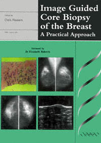 title Image Guided Core Biopsy of the Breast A Practical Approach - photo 1