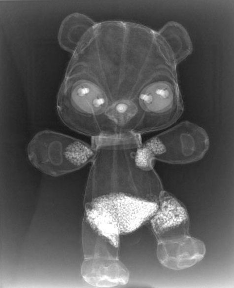 The Foreign Body A collection of the most interesting X-rays of things - photo 1